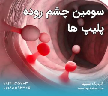 سومین چشم روده پلیپ ها