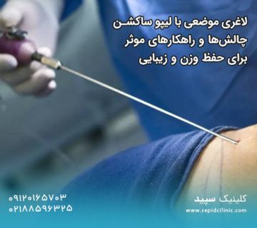 لاغری موضعی با لیپو ساکشن چالش‌ها و راهکارهای موثر برای حفظ وزن و زیبایی