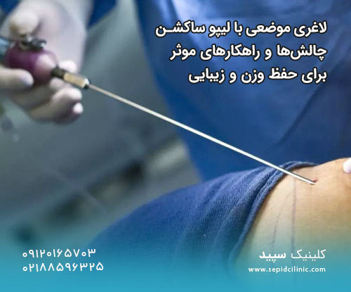 لاغری موضعی با لیپو ساکشن چالش‌ها و راهکارهای موثر برای حفظ وزن و زیبایی