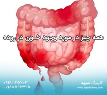 همه چیز در مورد وجود خون در روده 360x320