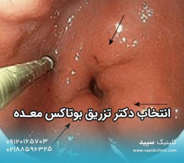 انتخاب دکتر تزریق بوتاکس معده