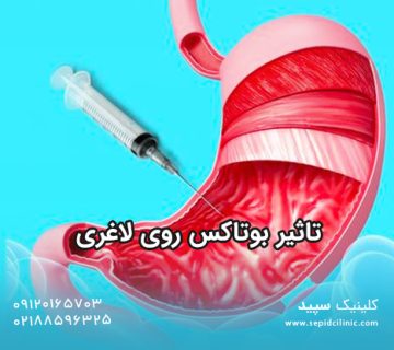 تاثیر بوتاکس روی لاغری