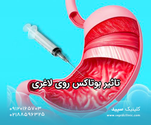 تاثیر بوتاکس روی لاغری