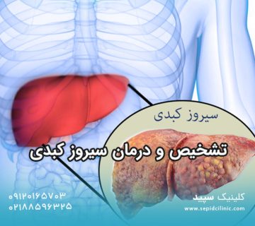 تشخیص و درمان سیروز کبدی