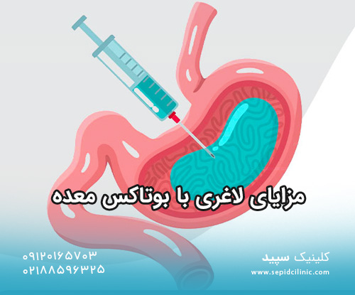 مزایای لاغری با بوتاکس معده