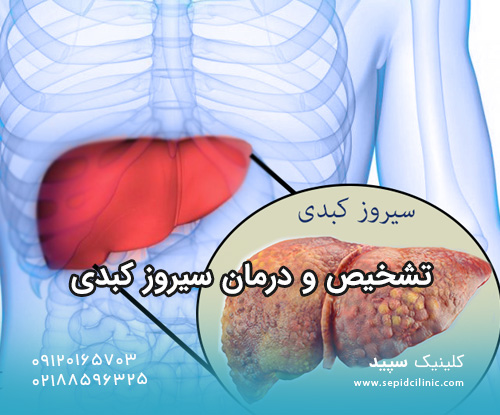 تشخیص و درمان سیروز کبدی
