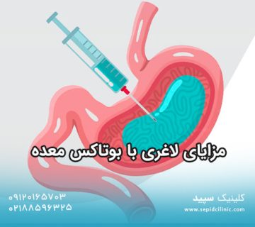 مزایای لاغری با بوتاکس معده