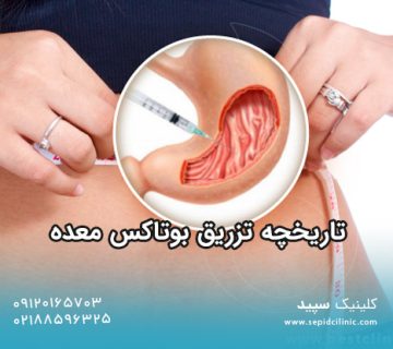 تاریخچه تزریق بوتاکس معده