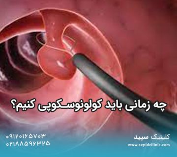 چه زمانی باید کولونوسکوپی کنیم؟