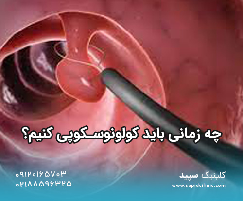 چه زمانی باید کولونوسکوپی کنیم؟