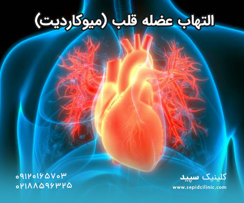 التهاب عضله قلب