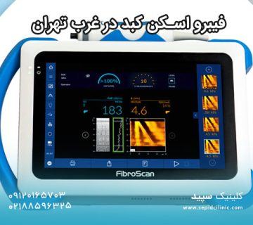 فیبرو اسکن کبد در غرب تهران