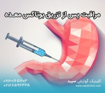 مراقبت پس از تزریق بوتاکس معده