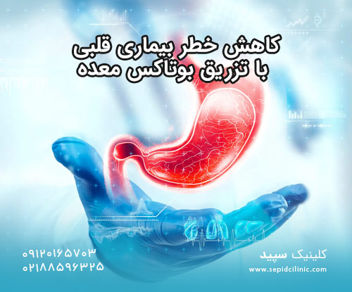 کاهش خطر بیماری قلبی با تزریق بوتاکس معده