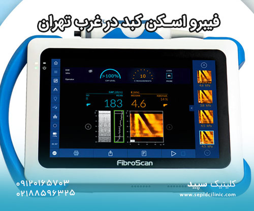 فیبرو اسکن کبد در غرب تهران