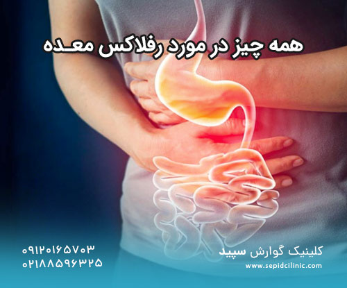 همه چیز در مورد رفلاکس معده