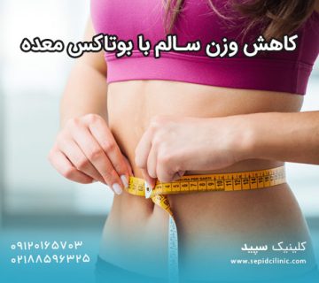 کاهش وزن سالم با بوتاکس معده