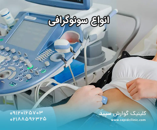 انواع سونوگرافی
