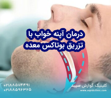 درمان آپنه خواب با تزریق بوتاکس معده