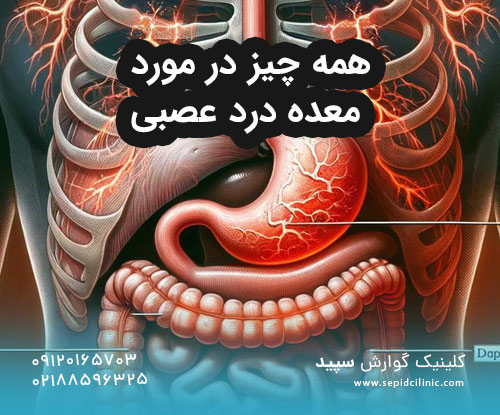 همه چیز در مورد معده درد عصبی