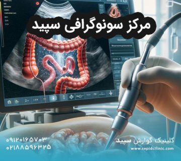 مرکز سونوگرافی سپید