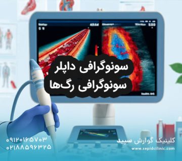 سونوگرافی رگ‌ها