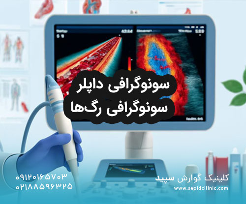 سونوگرافی رگ‌ها