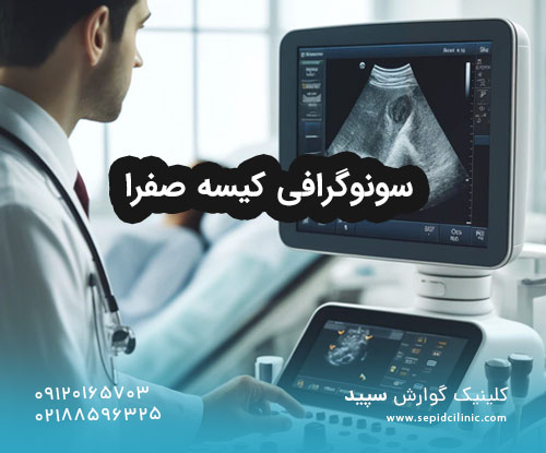 سونوگرافی کیسه صفرا