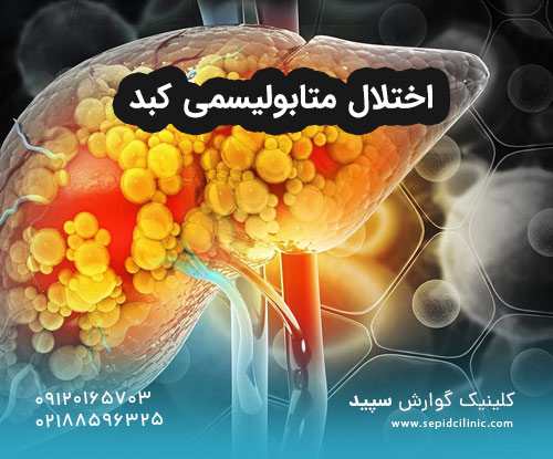 اختلال متابولیسمی کبد
