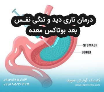 درمان تاری دید و تنگی نفس بعد بوتاکس معده