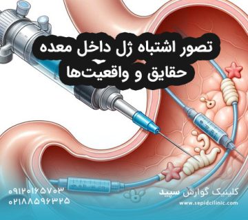 تصور اشتباه ژل داخل معده