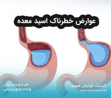 عوارض خطرناک اسید معده