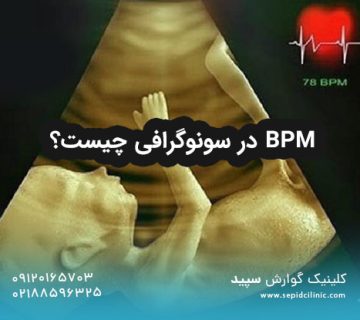 BPM در سونوگرافی چیست؟