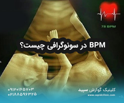 BPM در سونوگرافی چیست؟
