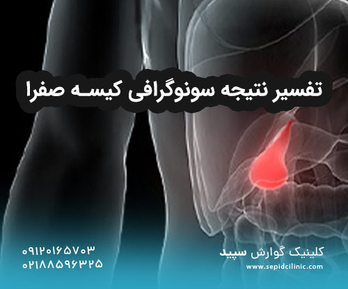 تفسیر نتیجه سونوگرافی کیسه صفرا
