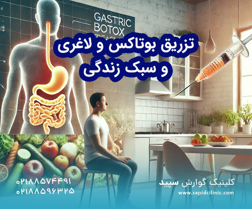 بوتاکس معده و تأثیر آن بر سبک زندگی