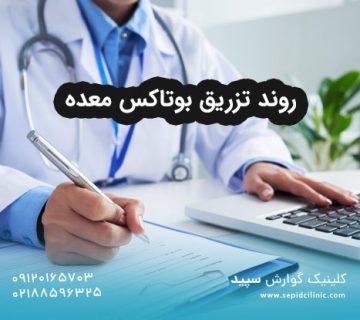 روند تزریق بوتاکس معده