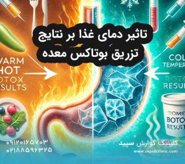 تاثیر دمای غذا بر نتایج تزریق بوتاکس معده
