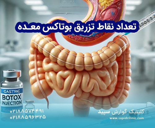 عوامل مؤثر در تعیین تعداد نقاط تزریق