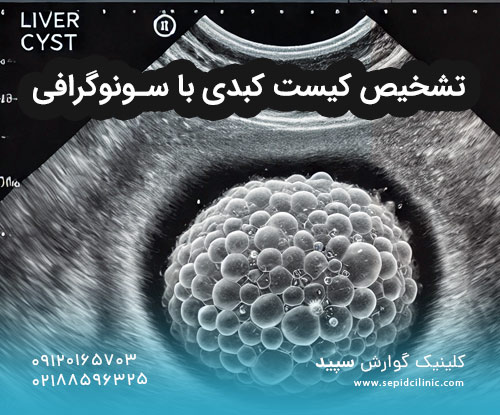 تشخیص کیست کبدی با سونوگرافی
