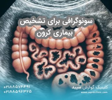 سونوگرافی برای تشخیص بیماری کرون