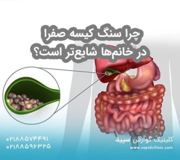 چرا سنگ کیسه صفرا در خانم‌ها شایع‌تر است؟