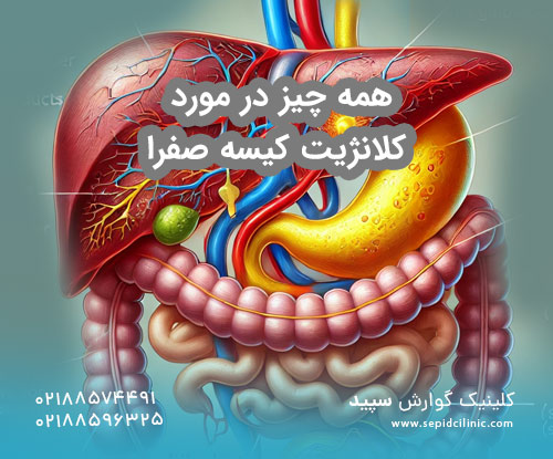 کلانژیت کیسه صفرا