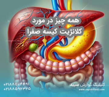 کلانژیت کیسه صفرا