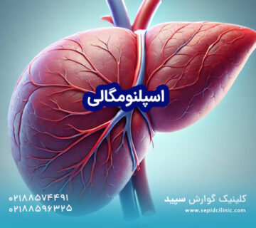 اسپلنومگالی