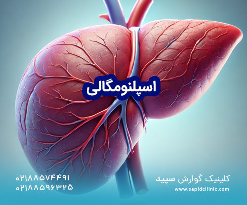 اسپلنومگالی