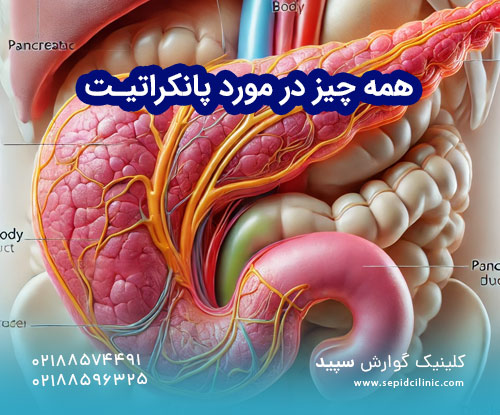 همه چیز در مورد پانکراتیت