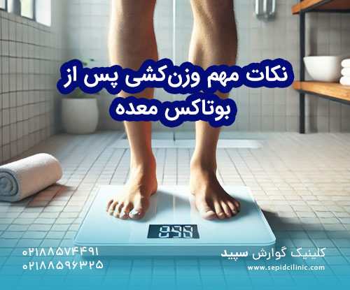 نکات مهم وزن‌کشی پس از بوتاکس معده