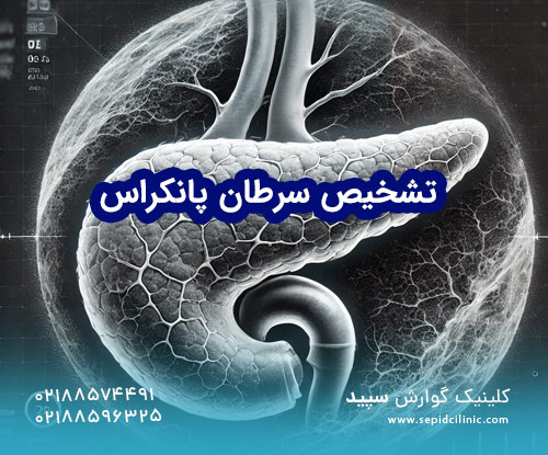 تشخیص سرطان پانکراس
