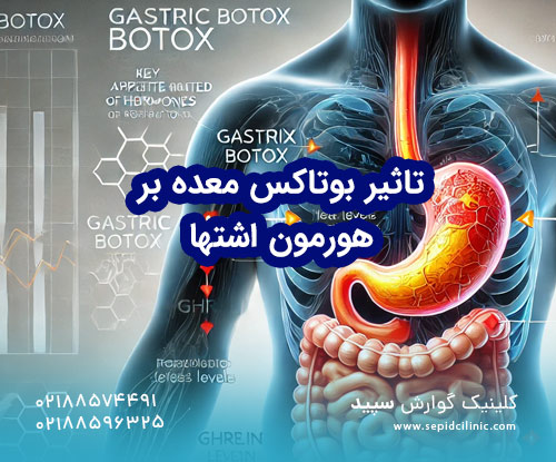 تأثیر بوتاکس معده بر تغییرات هورمونی مرتبط با اشتها